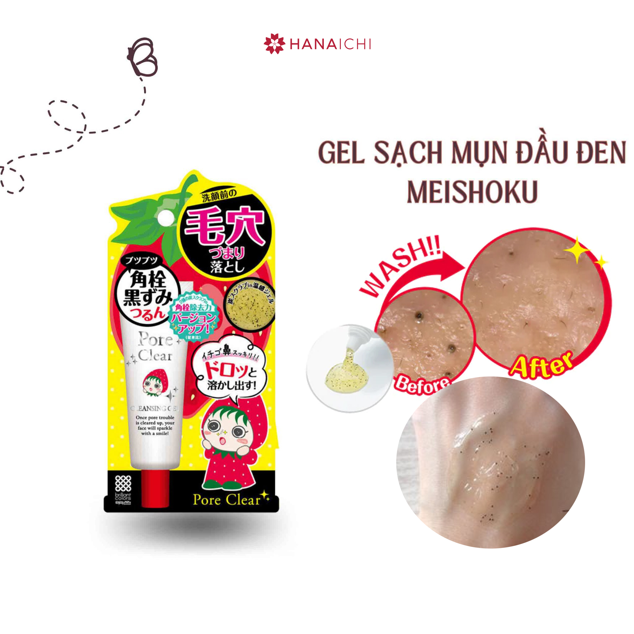 Gel lột mụn 9