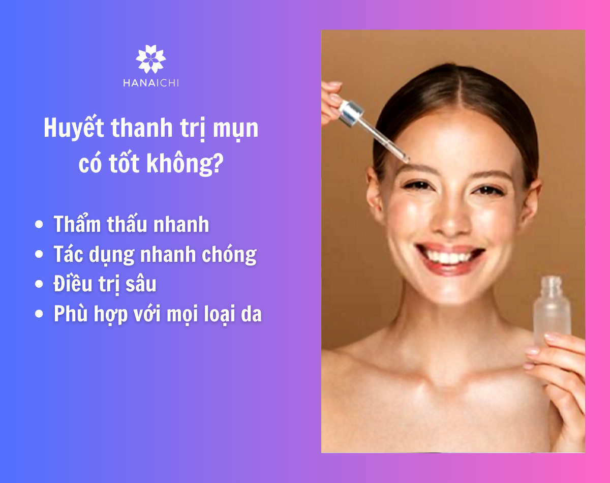 Huyết thanh trị mụn là sản phẩm hoàn hảo trong điều trị mụn chuyên sâu