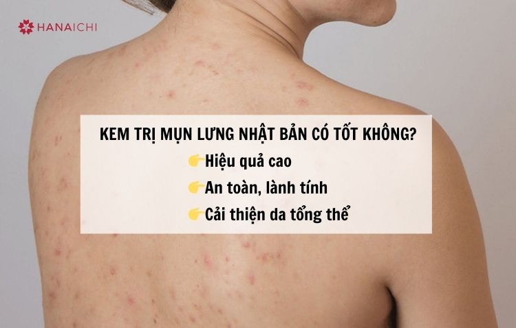 Kem trị mụn lưng Nhật Bản