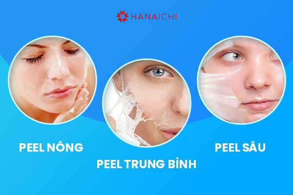 Peel da trị mụn là gì 4