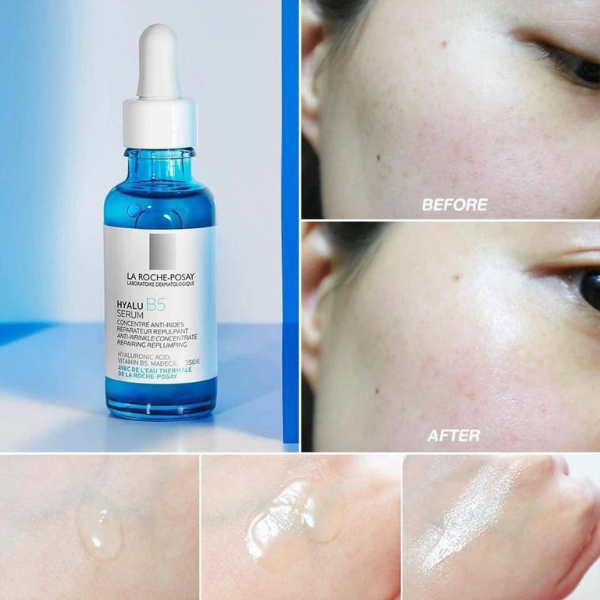 Serum B5 La Roche-Posay mang đến cả hiệu quả dưỡng ẩm và mờ thâm nám. 