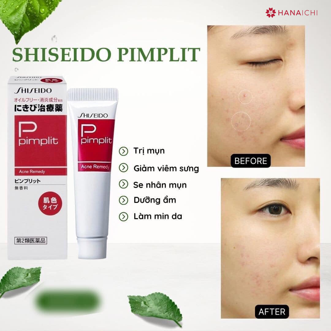 SHISEIDO Pimplit 15gr nhanh chóng làm giảm các vết mụn sưng đỏ, giúp làm dịu và ngăn ngừa mụn tái phát