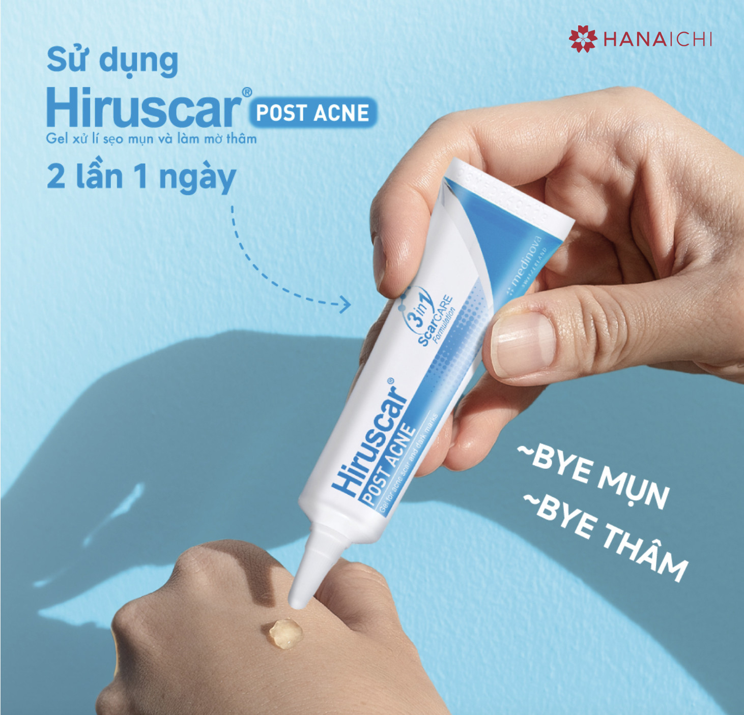 Hiruscar Post Acne Gel được chiết xuất hành tây giúp giảm thâm và ngăn ngừa sẹo