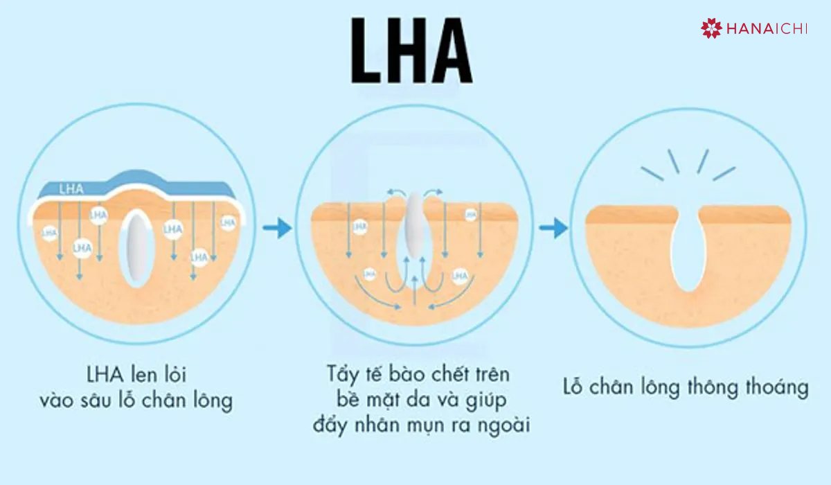 Sử dụng đúng cách sẽ giúp LHA phát huy tối đa công dụng